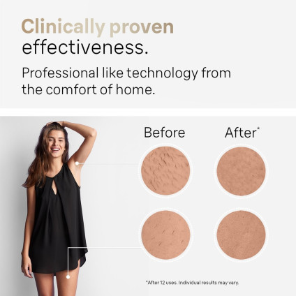 Фотоэпилятор Braun Silk-expert Pro 5 PL5382