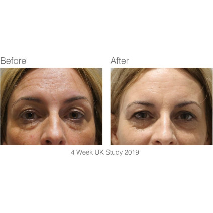 Маска для омоложения лица Rio FCLT2