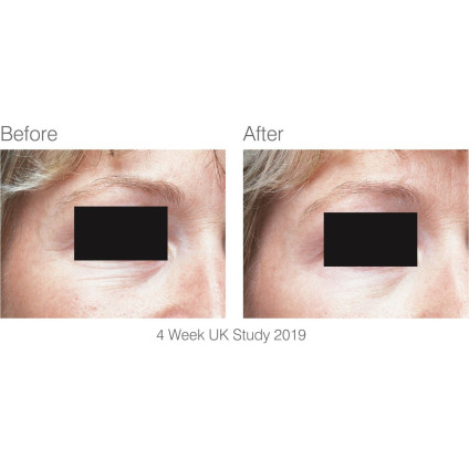 Маска для омоложения лица Rio FCLT2