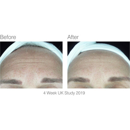 Маска для омоложения лица Rio FCLT2