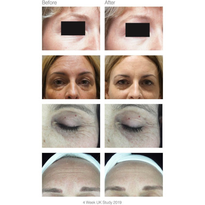 Маска для омоложения лица Rio FCLT2